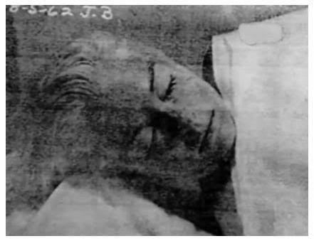 marilyn_monroe_autopsy2.jpg Photo by nuvia1mayra2 